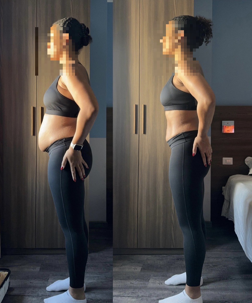 Before and after — 10-day method (face hidden for privacy)