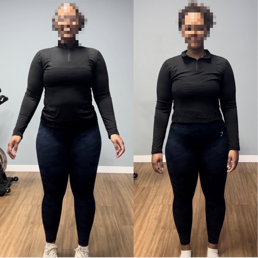 Before and after — 10-day method (face hidden for privacy)